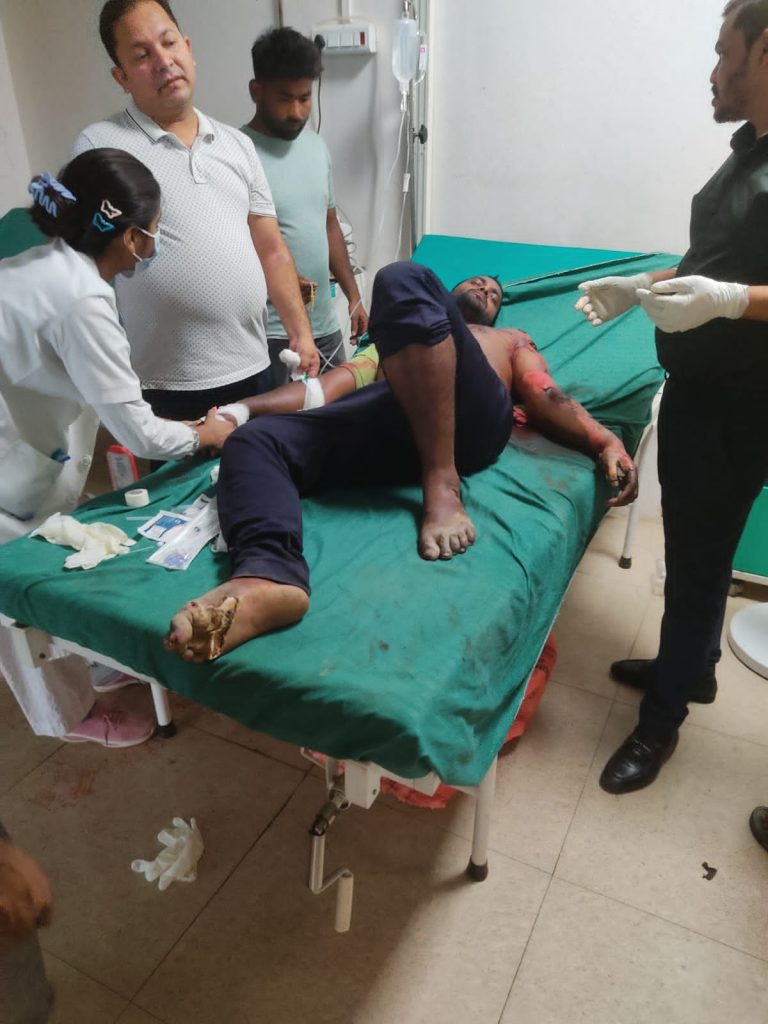 विद्युत लाइनमैन करंट की चपेट में आने से गंभीर रूप से झुलसा, जांच और सहायता की उठी मांग।