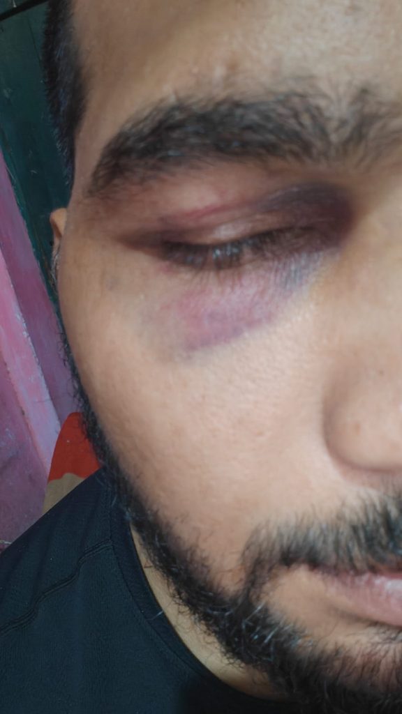 हमले के आरोपितों की गिरफ्तारी की मांग, विहिप-बजरंग दल ने दी थाना घेराव की चेतावनी।