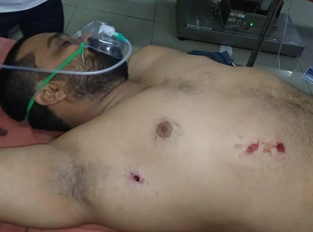 रक्षाबंधन पर घर लौटे युवक को बदमाशों ने मारी तीन गोलियां।
